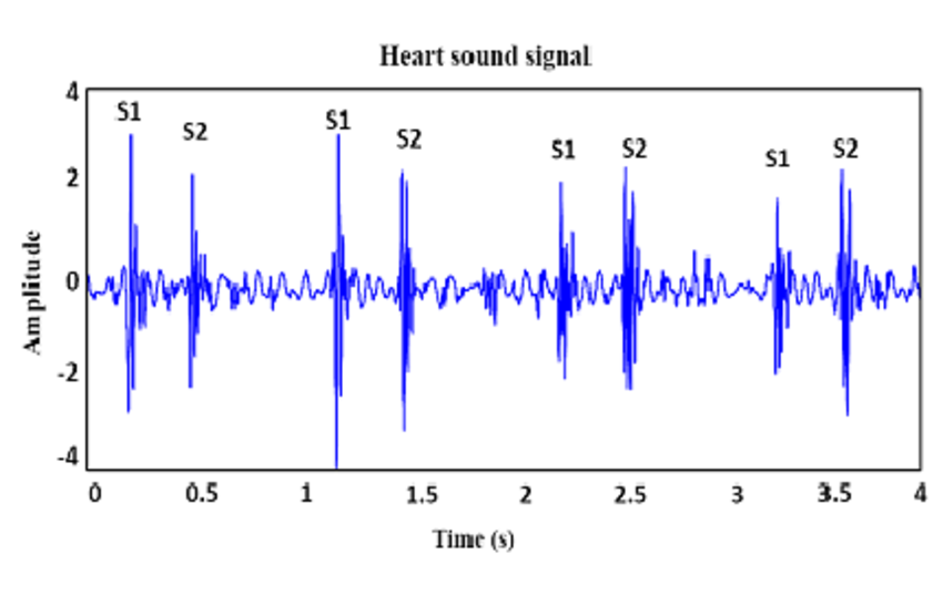 PCG Signal Analysis with Adaptive Filtering